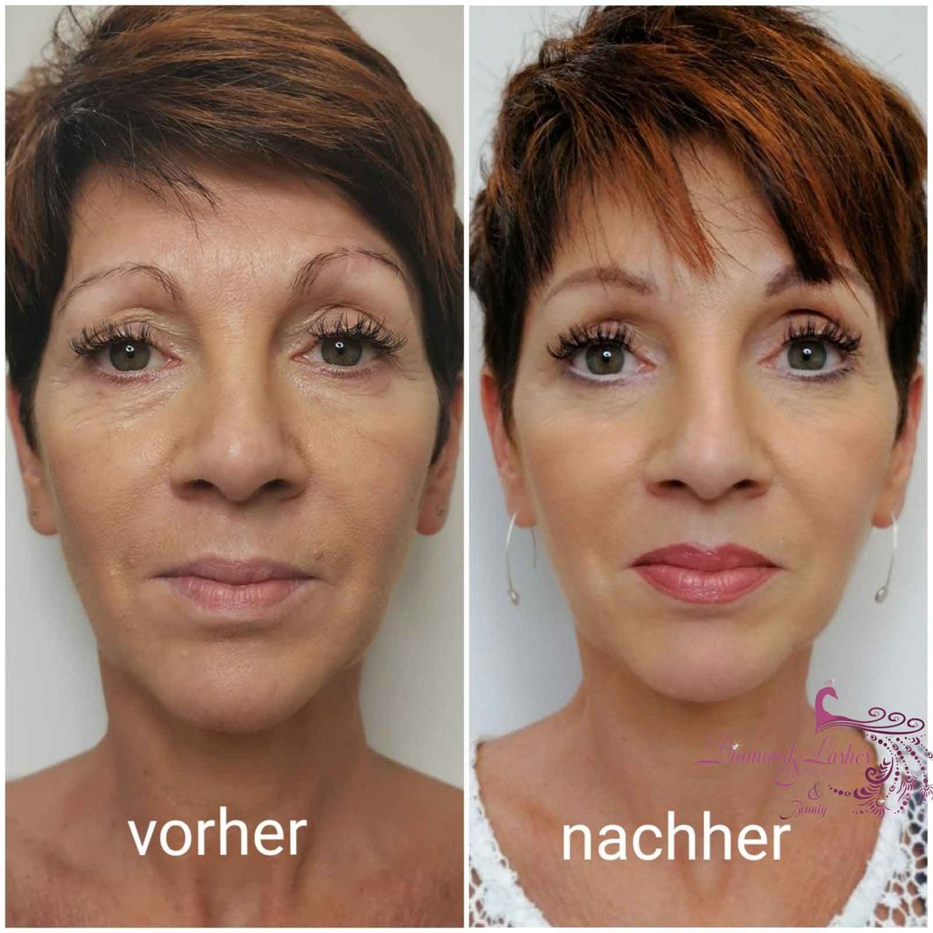 Vorher-nachher-Vergleich: Permanent Make-up an Augenbrauen, Lidstrich und Lippen